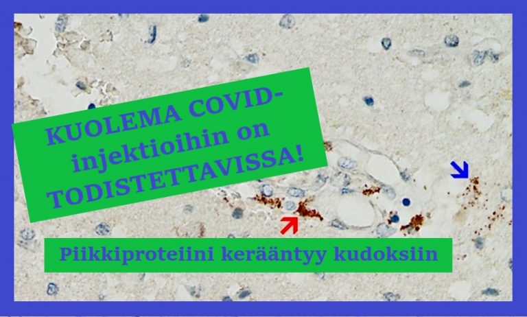 Halutaanko Suomessa oikeasti selvittää, kuoliko ihminen COVID-injektioiden haittavaikutuksiin?